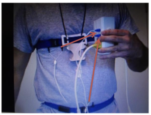 Completed belt set-up. Note that the chest belt wires face down, while the abdominal belt wires face up. Plug the blue inputs of each belt wire into the Alice PDx. Chest belt plugs into “Thoracic”. Stomach belt plugs into “Abdominal”.