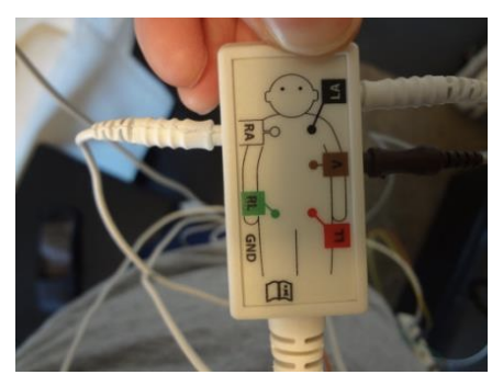 Plug these electrodes into the corresponding<br />
location on the EKG yoke seen in Figure 7.<br />
Electrode near left shoulder plugs into LA.<br />
Electrode near right shoulder plugs into RA.<br />
Electrode on left lower rib plugs into ‘V’.