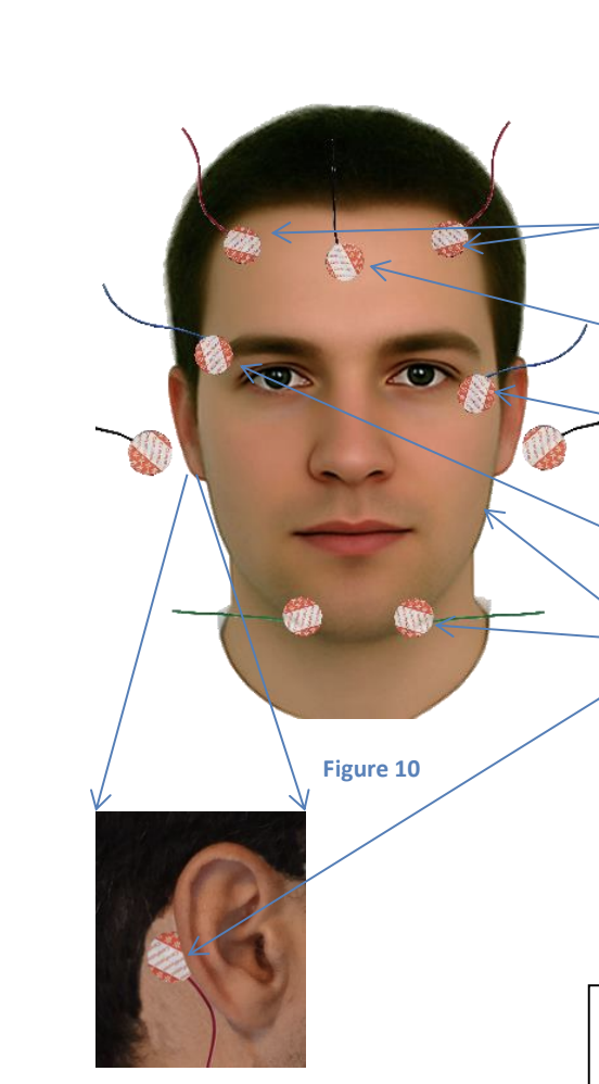 Firmly scrub the locations (seen in Figure 10 and 11) using an alcohol prep pad. Ensure the electrode wires are directed away from your face as shown. (Figure 10)