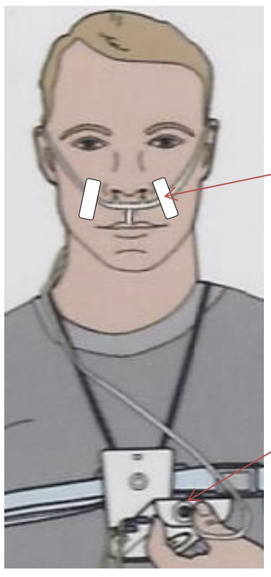 Put the nasal cannula prongs in your nose and pull over your ears. It is HIGHLY recommended that a one inch piece of cloth tape be applied to keep the cannula in place. Apply the tape on each side of the nose as close to the nose as possible. It is highly likely the cannula will become dislodged during the night if the tape is not applied. Twist the cannula into the luer lock on the top of the PDx module.