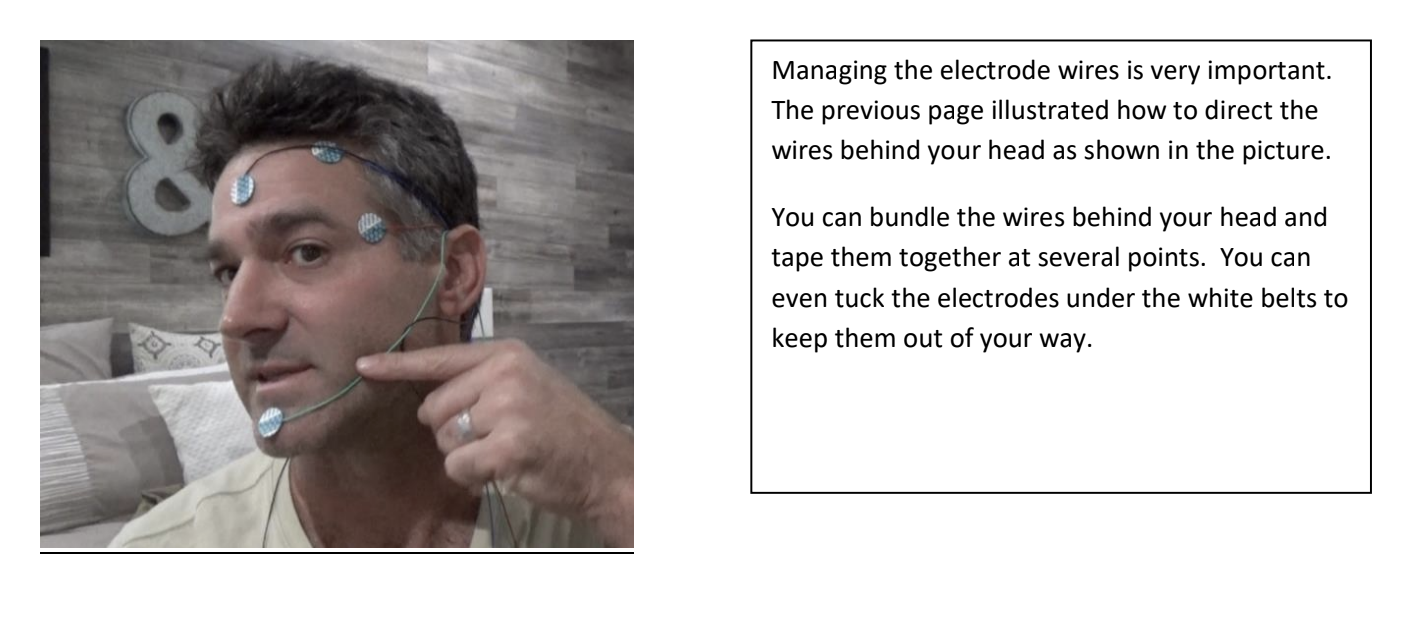 Managing the electrode wires is very important.